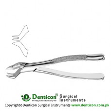 Nevius American Pattern Tooth Extracting Forcep Fig 88R (For Upper Right Molars) Stainless Steel, Standard
